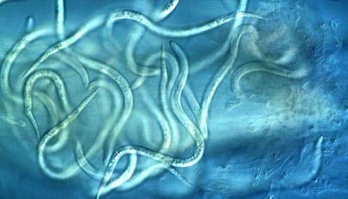 Como son os parasitos dos nematodos no corpo humano